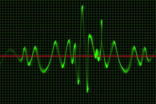 Phase and Phase Shift Concepts in Signals